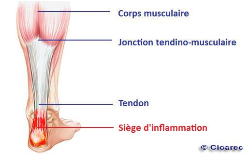 schéma-tendon